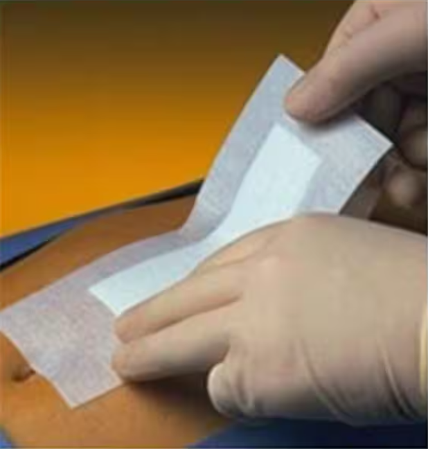 Primapore Polyester Post Op Island Dressing 4x3-1/8" Sterile LF, 10 BX/CA